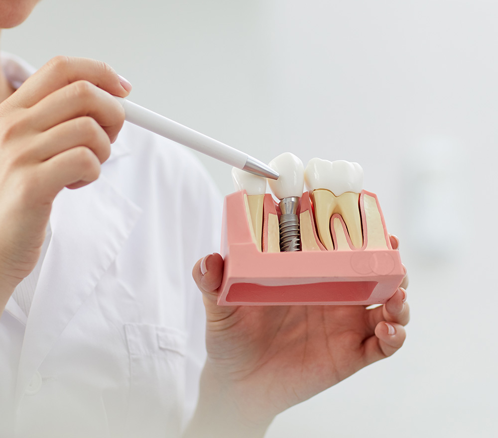 歯科衛生士担当制のメリット